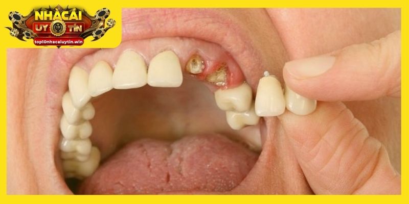 Giấc mơ răng sâu rụng, tín hiệu thay đổi tích cực